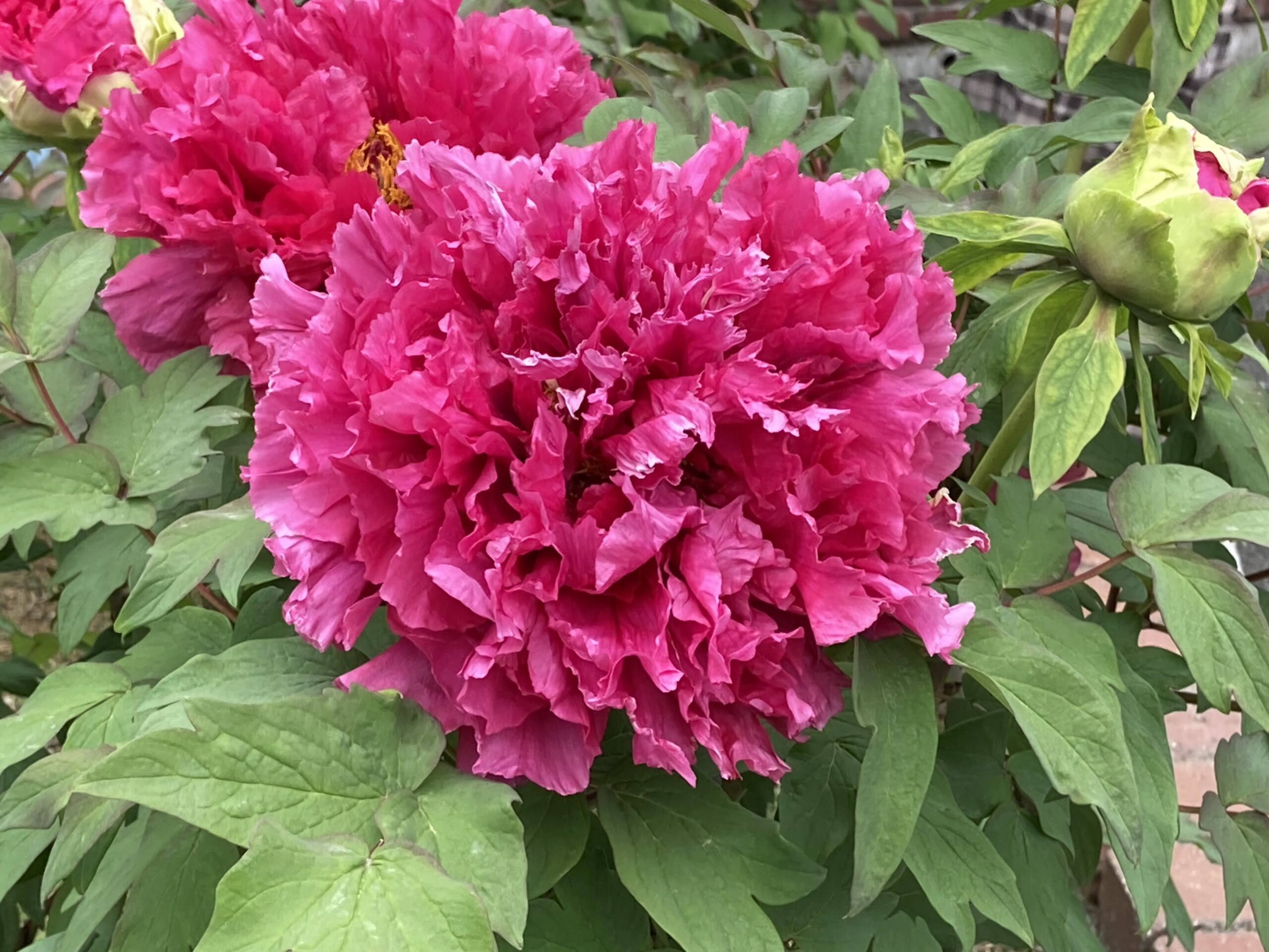 4. 鍼治療を試してみる